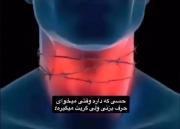 نمیشه واقعا انگار شیشه خورده گیر کرده 