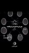 روانشناسان حرف دلمو زدن………………..